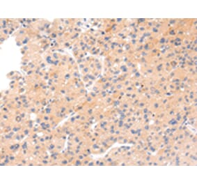 Immunohistochemistry - IKZF4 Antibody from Signalway Antibody (43211) - Antibodies.com