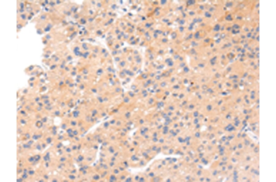 Immunohistochemistry - IKZF4 Antibody from Signalway Antibody (43211) - Antibodies.com