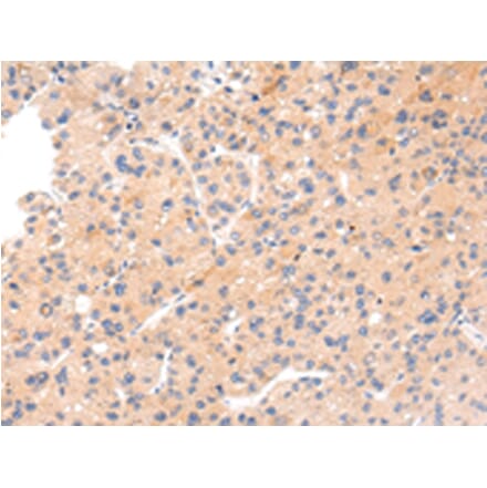 Immunohistochemistry - IKZF4 Antibody from Signalway Antibody (43211) - Antibodies.com