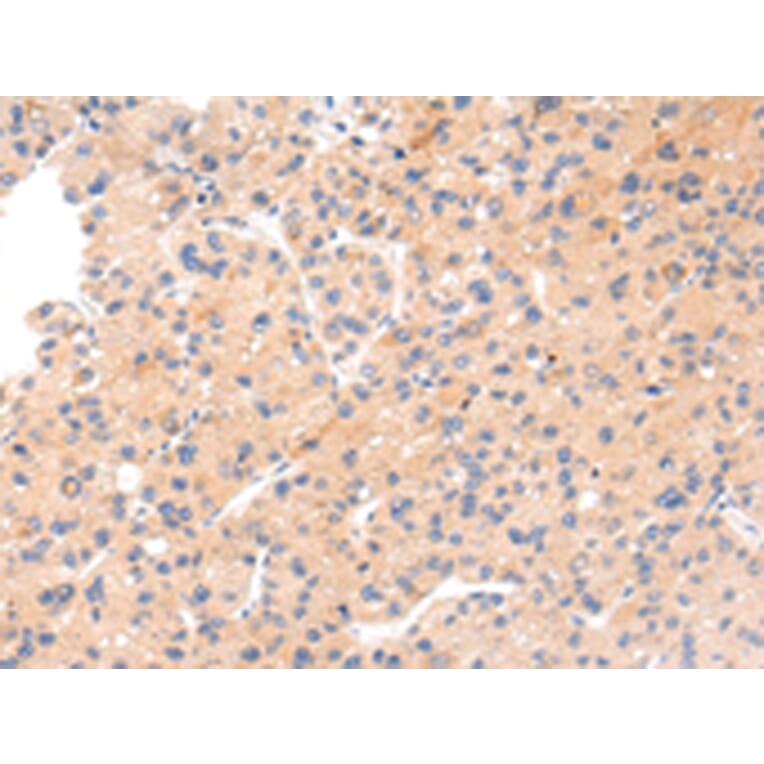 Immunohistochemistry - IKZF4 Antibody from Signalway Antibody (43211) - Antibodies.com