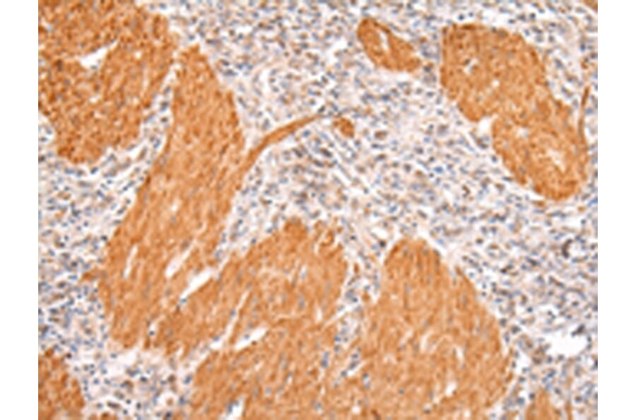 Immunohistochemistry - IKZF4 Antibody from Signalway Antibody (43211) - Antibodies.com