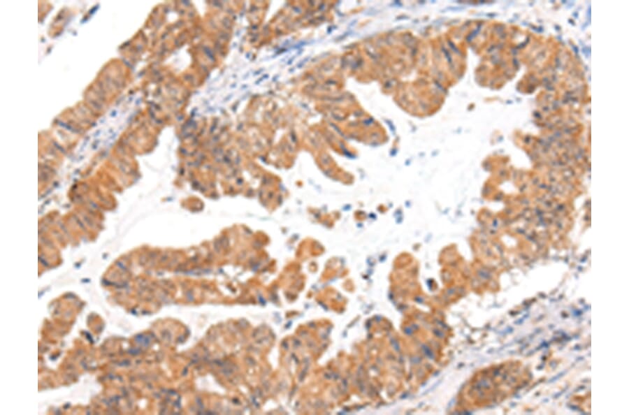 Immunohistochemistry - CASZ1 Antibody from Signalway Antibody (43214) - Antibodies.com