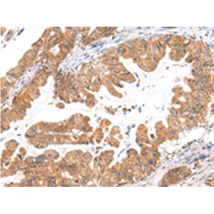 Immunohistochemistry - CASZ1 Antibody from Signalway Antibody (43214) - Antibodies.com