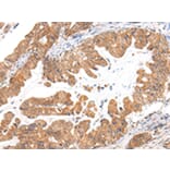 Immunohistochemistry - CASZ1 Antibody from Signalway Antibody (43214) - Antibodies.com