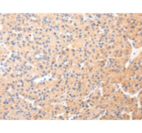 Immunohistochemistry - KRT20 Antibody from Signalway Antibody (43218) - Antibodies.com