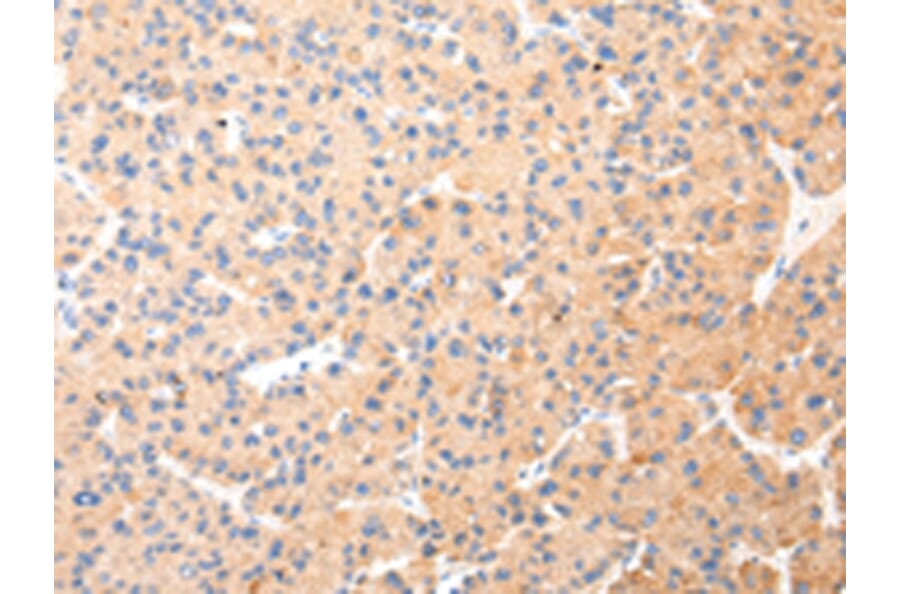 Immunohistochemistry - KRT20 Antibody from Signalway Antibody (43218) - Antibodies.com