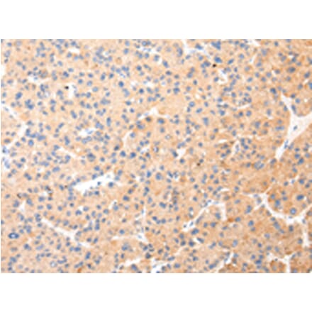 Immunohistochemistry - KRT20 Antibody from Signalway Antibody (43218) - Antibodies.com