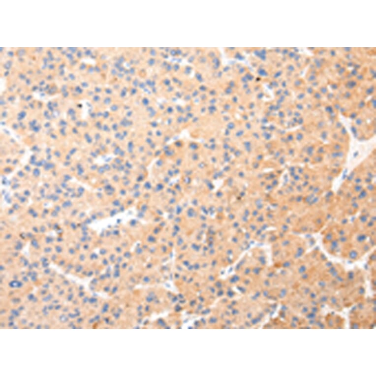 Immunohistochemistry - KRT20 Antibody from Signalway Antibody (43218) - Antibodies.com
