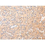 Immunohistochemistry - KRT20 Antibody from Signalway Antibody (43218) - Antibodies.com