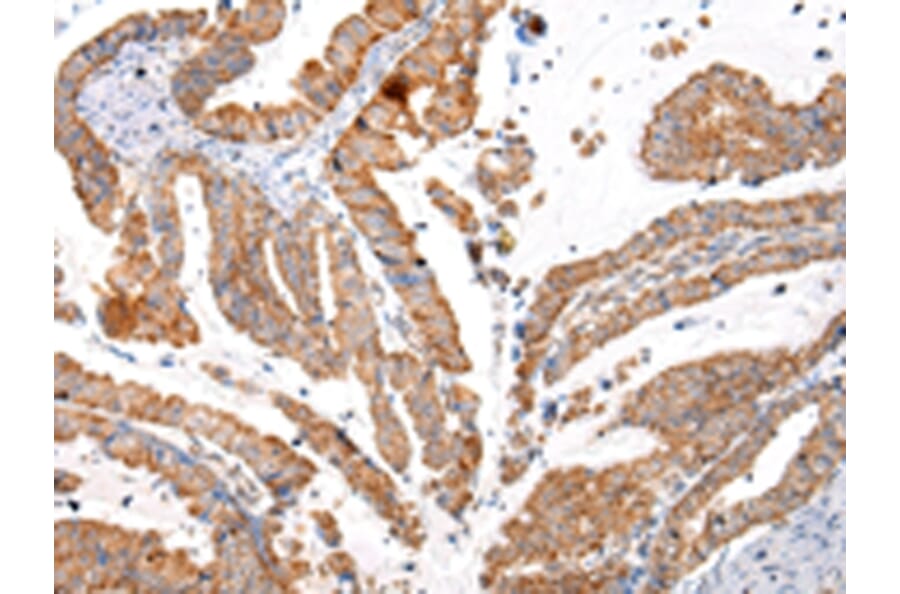 Immunohistochemistry - KRT20 Antibody from Signalway Antibody (43218) - Antibodies.com