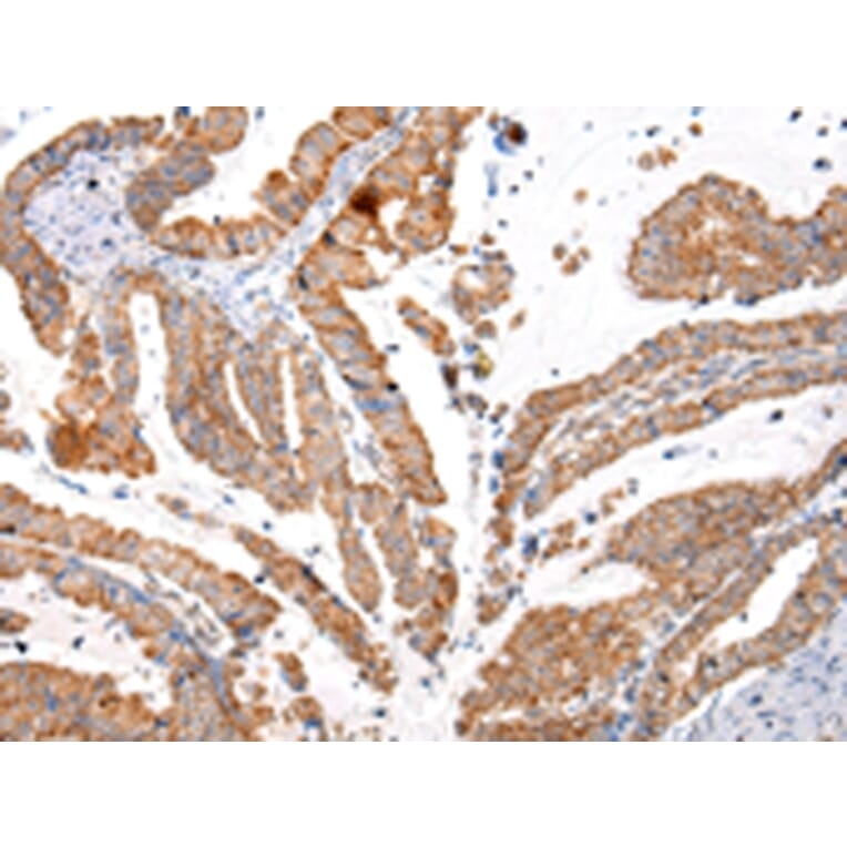 Immunohistochemistry - KRT20 Antibody from Signalway Antibody (43218) - Antibodies.com