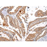 Immunohistochemistry - KRT20 Antibody from Signalway Antibody (43218) - Antibodies.com