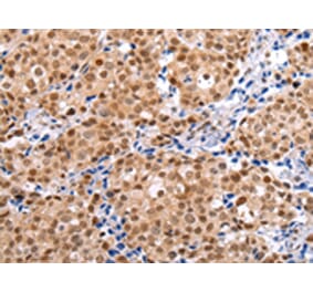 Immunohistochemistry - BRMS1 Antibody from Signalway Antibody (43231) - Antibodies.com