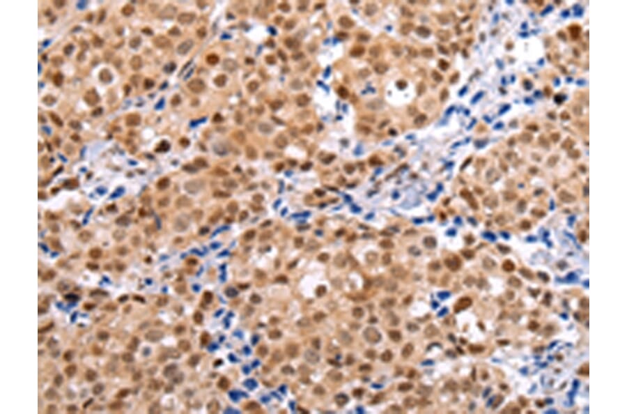Immunohistochemistry - BRMS1 Antibody from Signalway Antibody (43231) - Antibodies.com