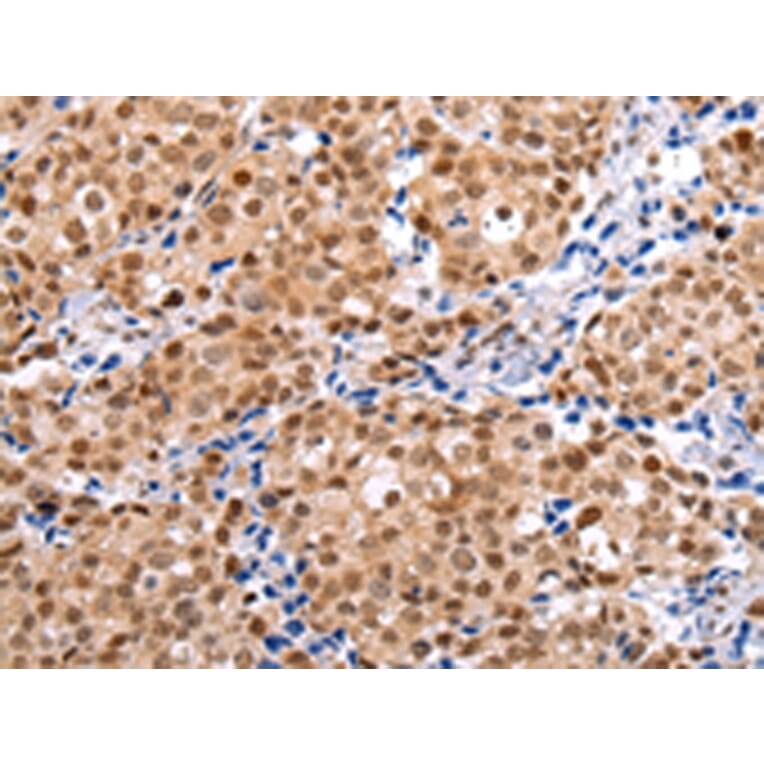 Immunohistochemistry - BRMS1 Antibody from Signalway Antibody (43231) - Antibodies.com