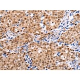 Immunohistochemistry - BRMS1 Antibody from Signalway Antibody (43231) - Antibodies.com