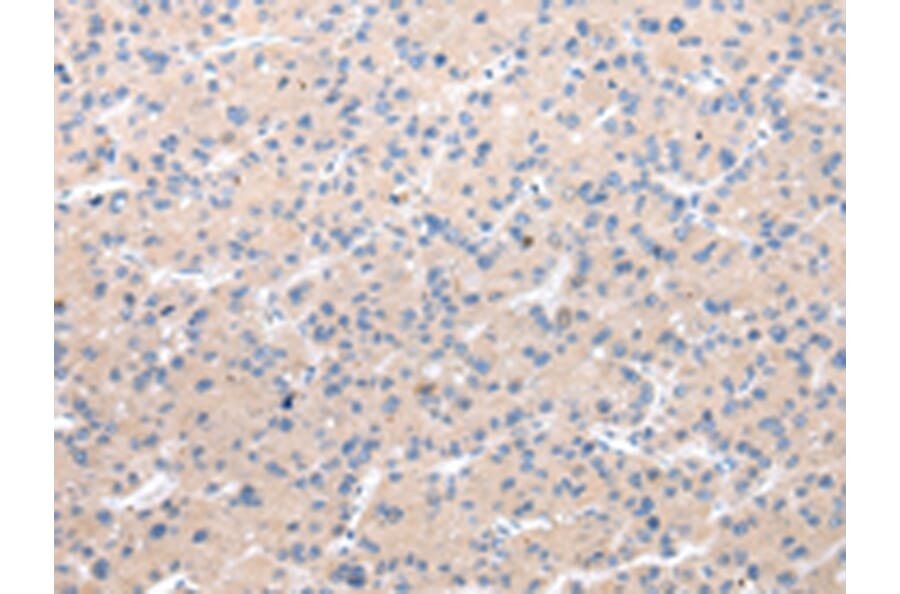 Immunohistochemistry - CHRM5 Antibody from Signalway Antibody (43235) - Antibodies.com