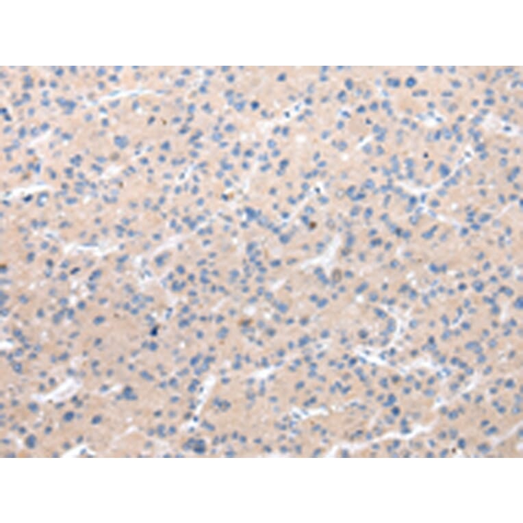 Immunohistochemistry - CHRM5 Antibody from Signalway Antibody (43235) - Antibodies.com