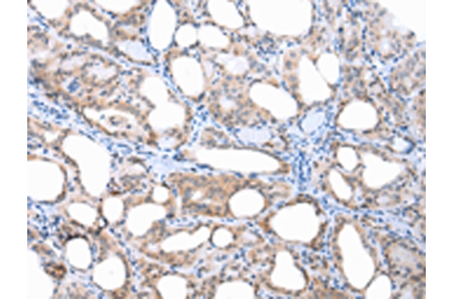 Immunohistochemistry - APH1A Antibody from Signalway Antibody (43249) - Antibodies.com