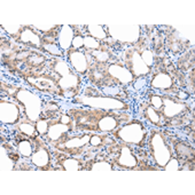 Immunohistochemistry - APH1A Antibody from Signalway Antibody (43249) - Antibodies.com