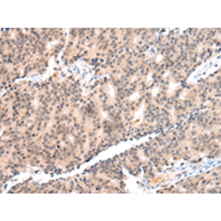 Immunohistochemistry - COX17 Antibody from Signalway Antibody (43251) - Antibodies.com