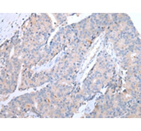 Immunohistochemistry - CCR10 Antibody from Signalway Antibody (43255) - Antibodies.com