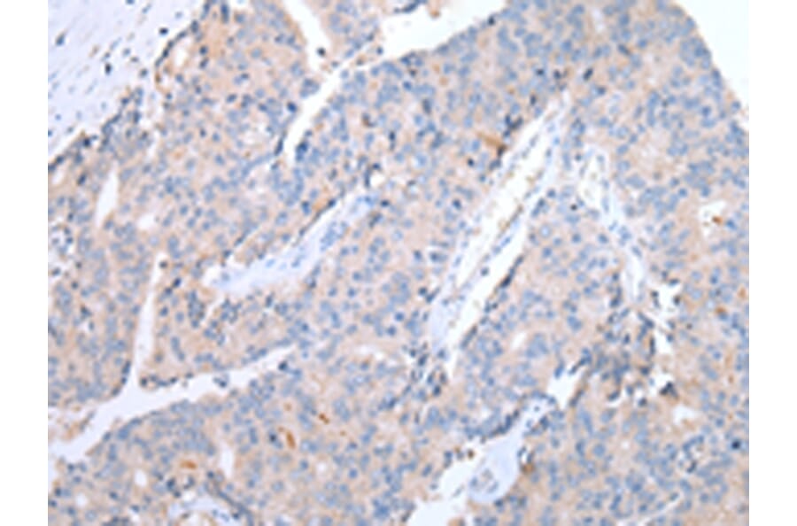 Immunohistochemistry - CCR10 Antibody from Signalway Antibody (43255) - Antibodies.com