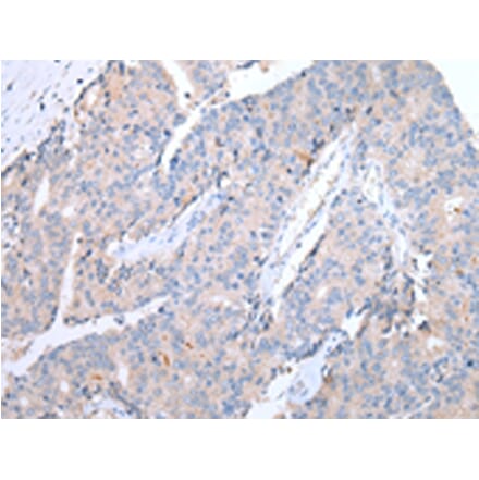 Immunohistochemistry - CCR10 Antibody from Signalway Antibody (43255) - Antibodies.com