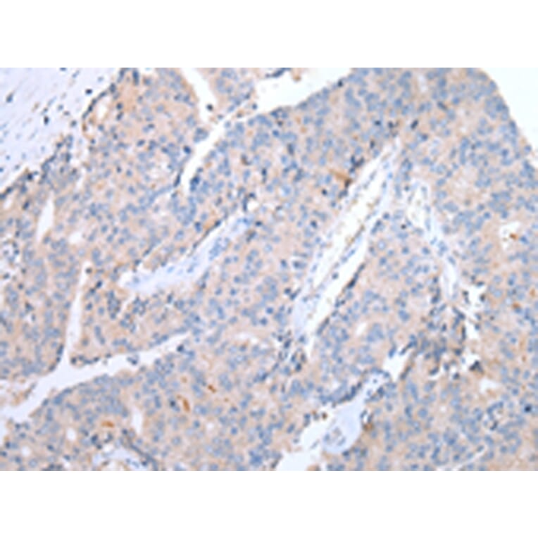 Immunohistochemistry - CCR10 Antibody from Signalway Antibody (43255) - Antibodies.com