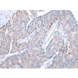 Immunohistochemistry - CCR10 Antibody from Signalway Antibody (43255) - Antibodies.com