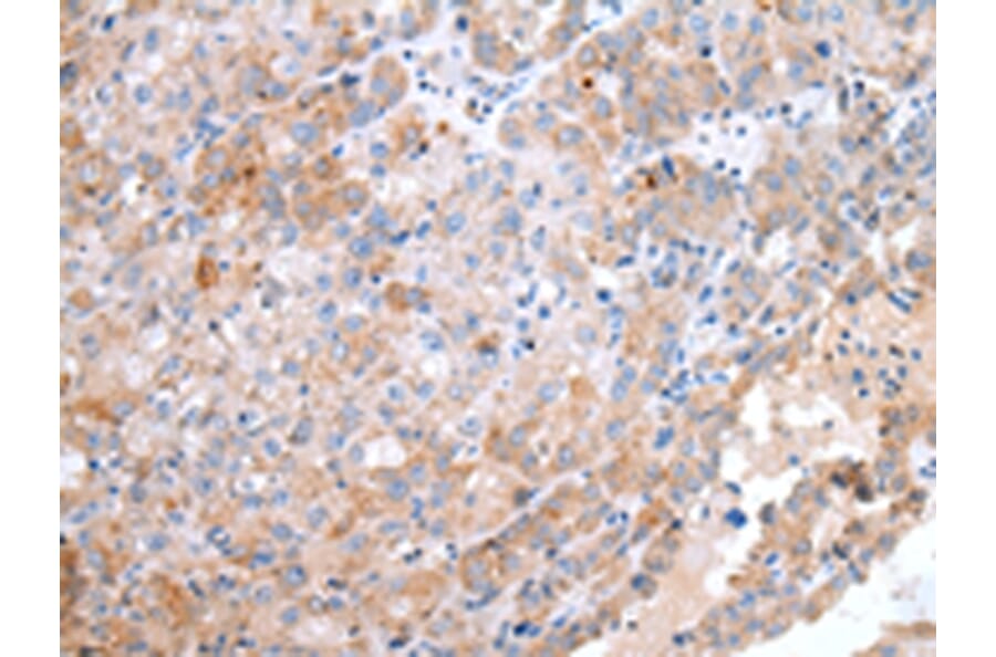 Immunohistochemistry - CCR10 Antibody from Signalway Antibody (43255) - Antibodies.com