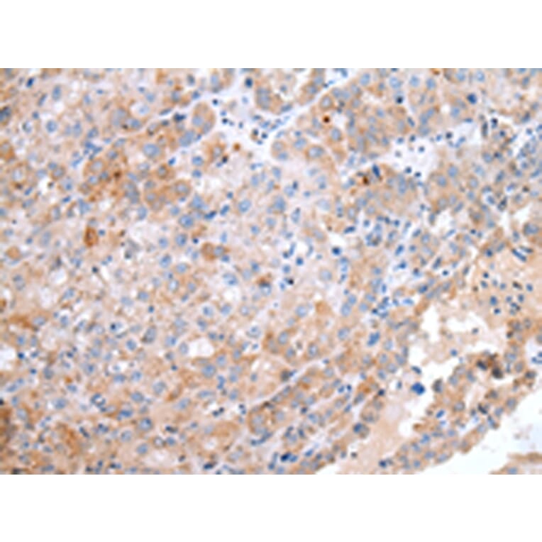 Immunohistochemistry - CCR10 Antibody from Signalway Antibody (43255) - Antibodies.com