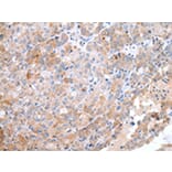 Immunohistochemistry - CCR10 Antibody from Signalway Antibody (43255) - Antibodies.com