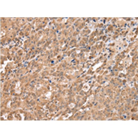 Immunohistochemistry - DDX58 Antibody from Signalway Antibody (43258) - Antibodies.com