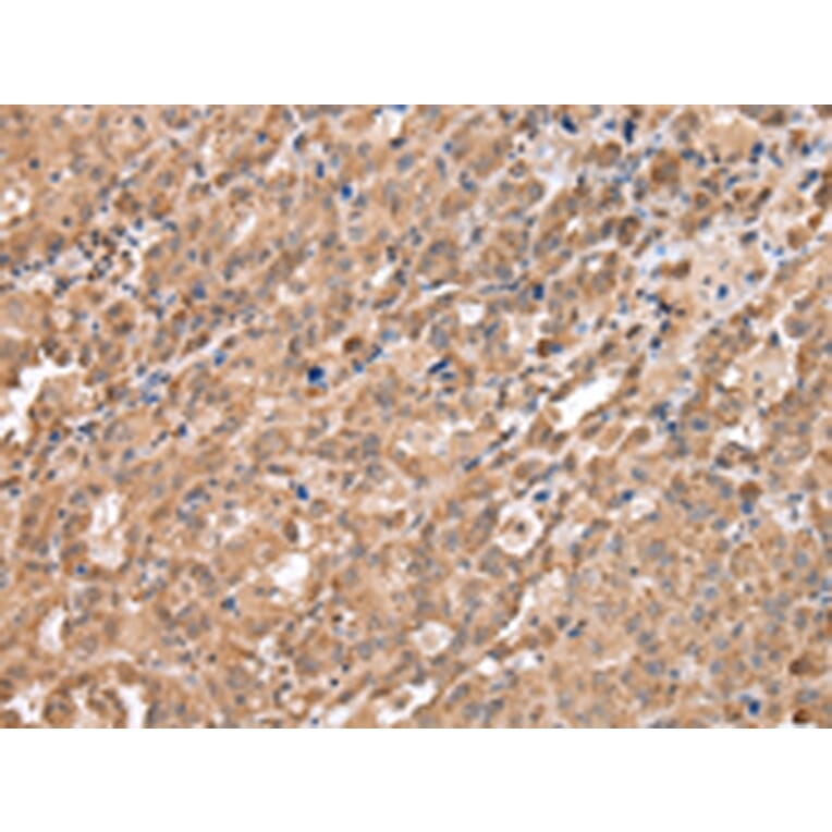 Immunohistochemistry - DDX58 Antibody from Signalway Antibody (43258) - Antibodies.com