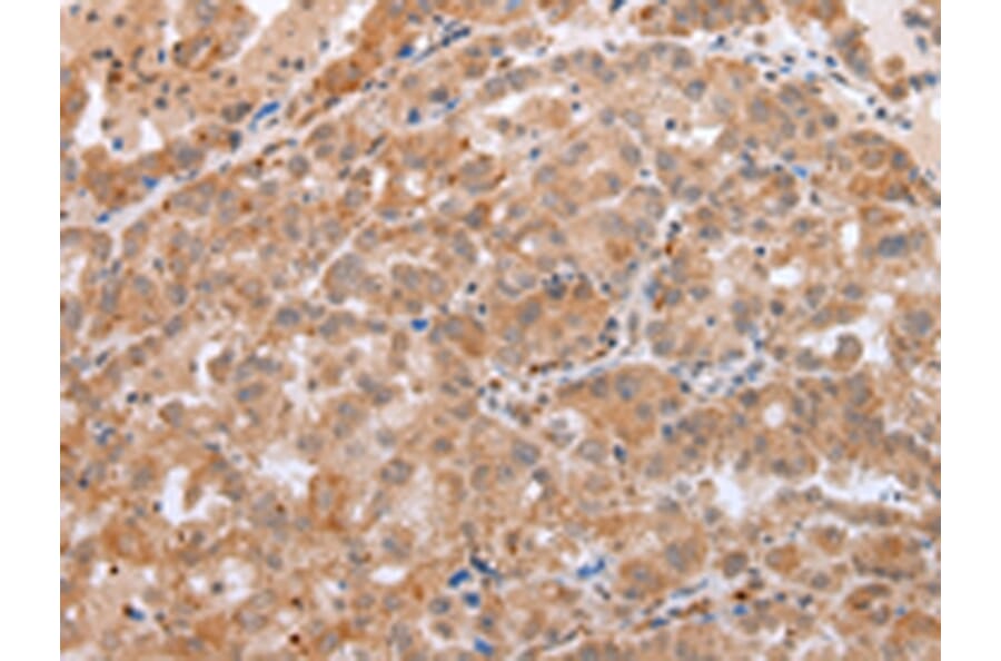 Immunohistochemistry - DEFB1 Antibody from Signalway Antibody (43260) - Antibodies.com
