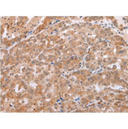 Immunohistochemistry - DEFB1 Antibody from Signalway Antibody (43260) - Antibodies.com