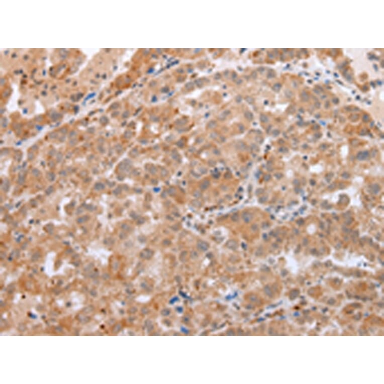 Immunohistochemistry - DEFB1 Antibody from Signalway Antibody (43260) - Antibodies.com