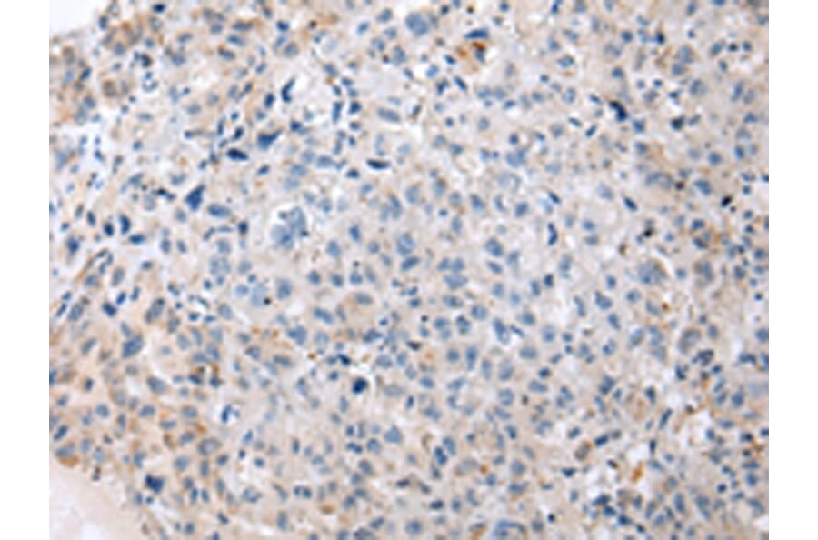 Immunohistochemistry - ENPP1 Antibody from Signalway Antibody (43266) - Antibodies.com