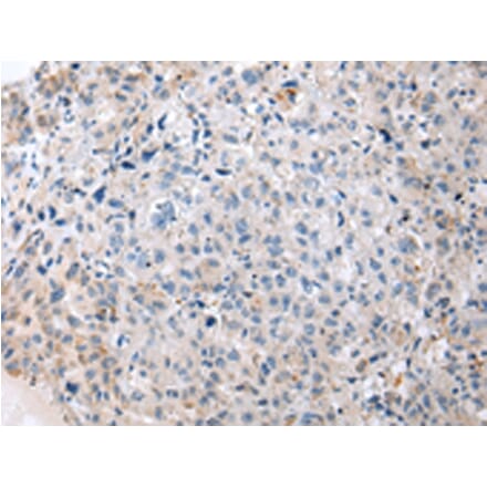 Immunohistochemistry - ENPP1 Antibody from Signalway Antibody (43266) - Antibodies.com