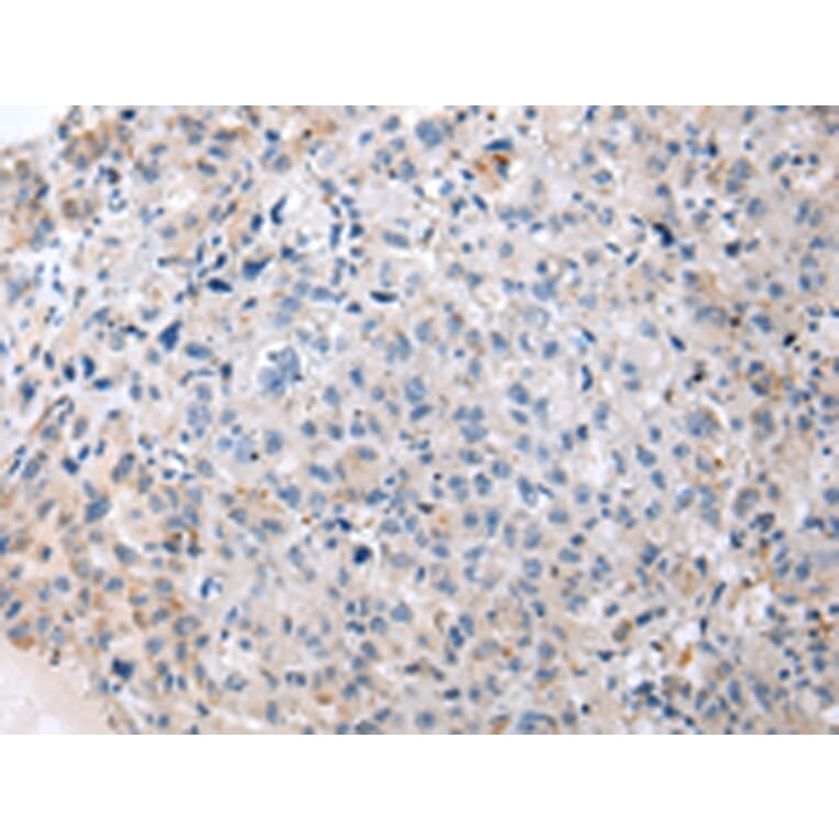 Immunohistochemistry - ENPP1 Antibody from Signalway Antibody (43266) - Antibodies.com