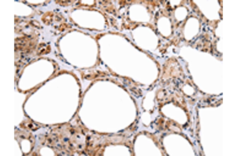 Immunohistochemistry - ENPP1 Antibody from Signalway Antibody (43266) - Antibodies.com