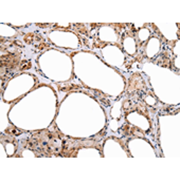 Immunohistochemistry - ENPP1 Antibody from Signalway Antibody (43266) - Antibodies.com