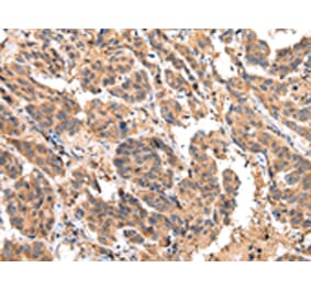 Immunohistochemistry - EPHA2 Antibody from Signalway Antibody (43267) - Antibodies.com