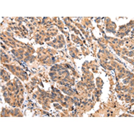 Immunohistochemistry - EPHA2 Antibody from Signalway Antibody (43267) - Antibodies.com