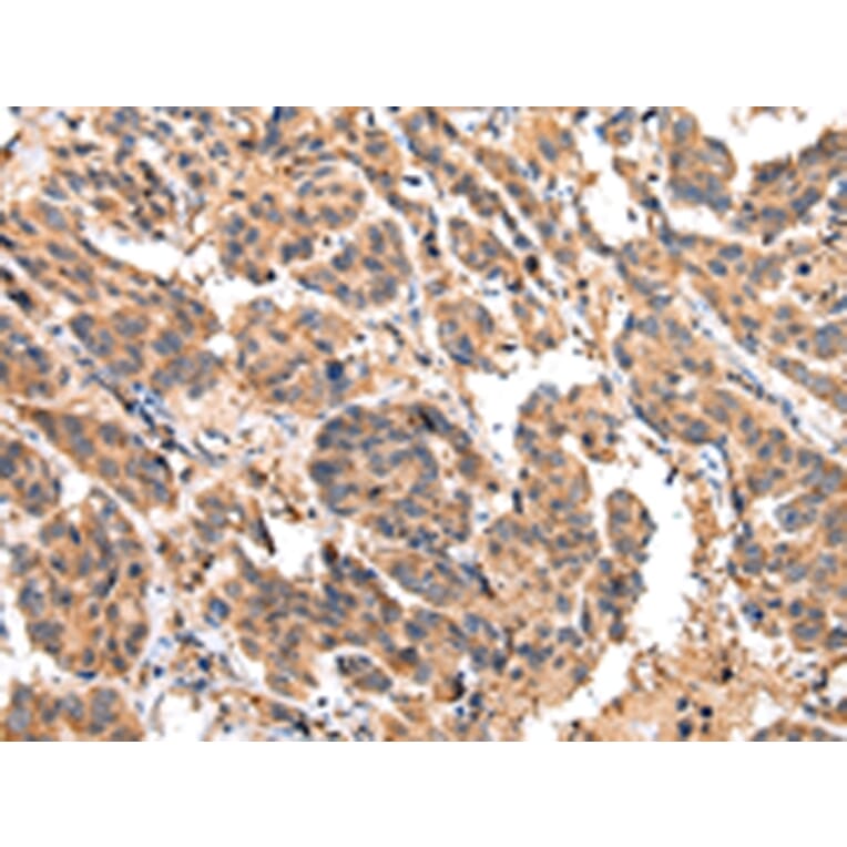 Immunohistochemistry - EPHA2 Antibody from Signalway Antibody (43267) - Antibodies.com