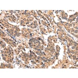 Immunohistochemistry - EPHA2 Antibody from Signalway Antibody (43267) - Antibodies.com