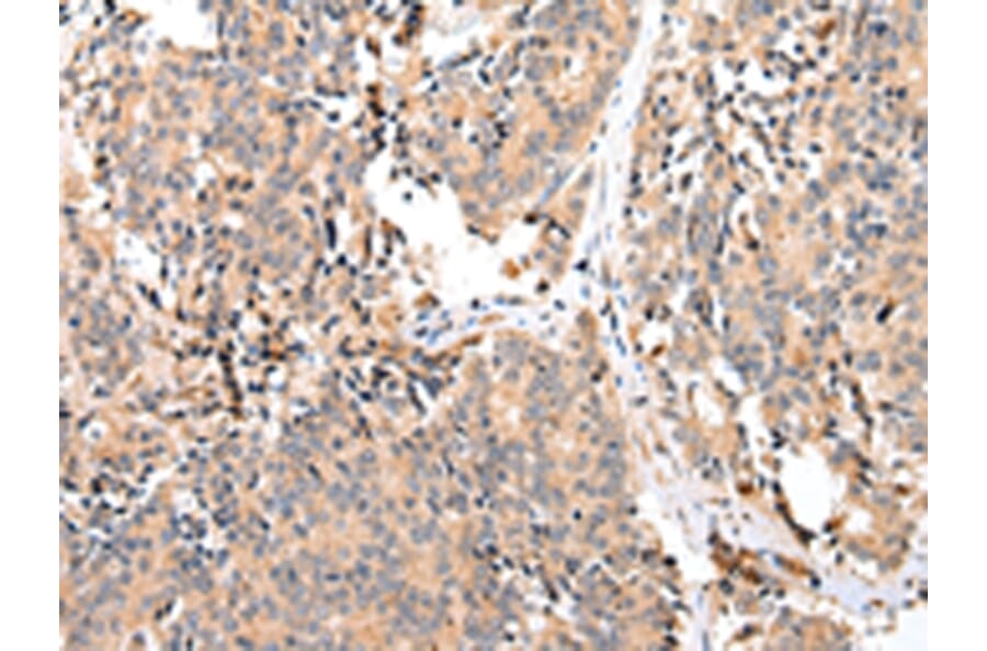 Immunohistochemistry - EPHA2 Antibody from Signalway Antibody (43267) - Antibodies.com