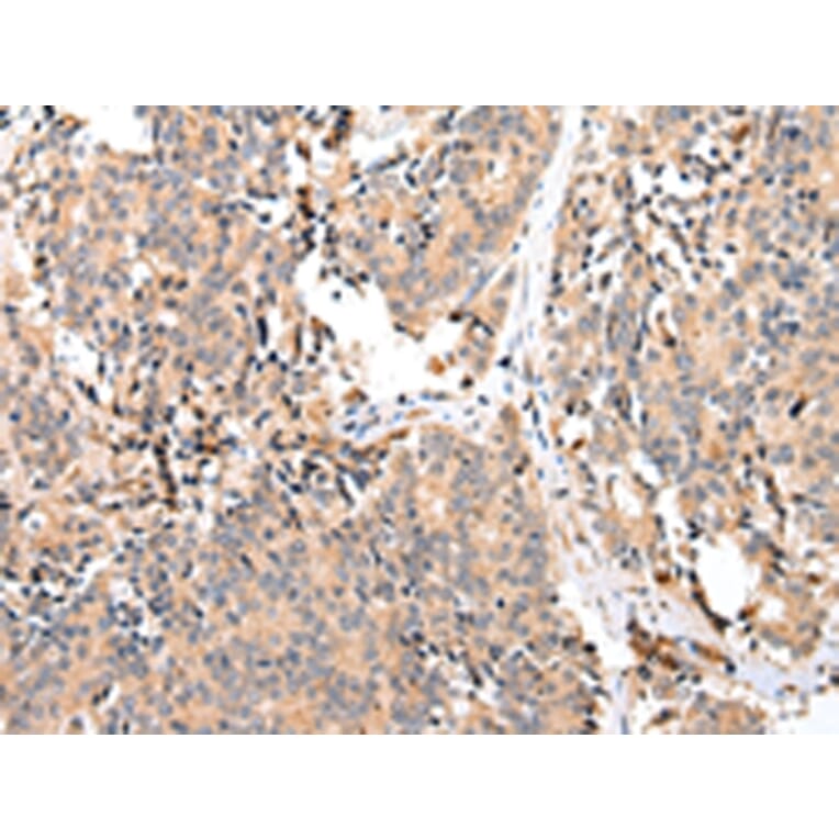 Immunohistochemistry - EPHA2 Antibody from Signalway Antibody (43267) - Antibodies.com