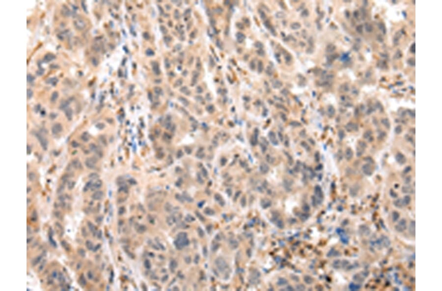 Immunohistochemistry - EPHB4 Antibody from Signalway Antibody (43268) - Antibodies.com